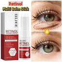 Bright Eyes Eye Cream for Dark Circles