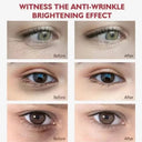 Bright Eyes Eye Cream for Dark Circles