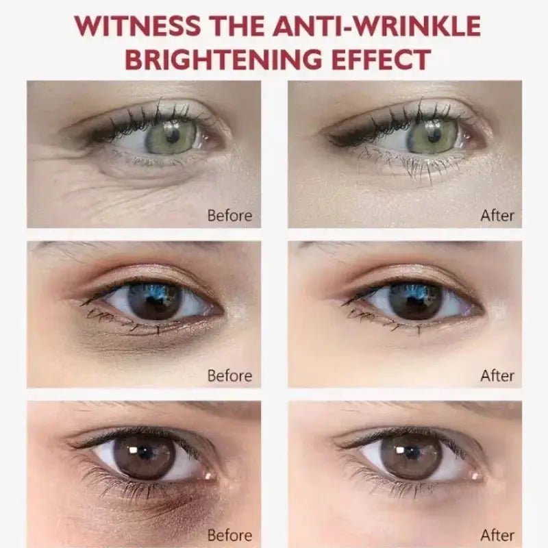 Bright Eyes Eye Cream for Dark Circles