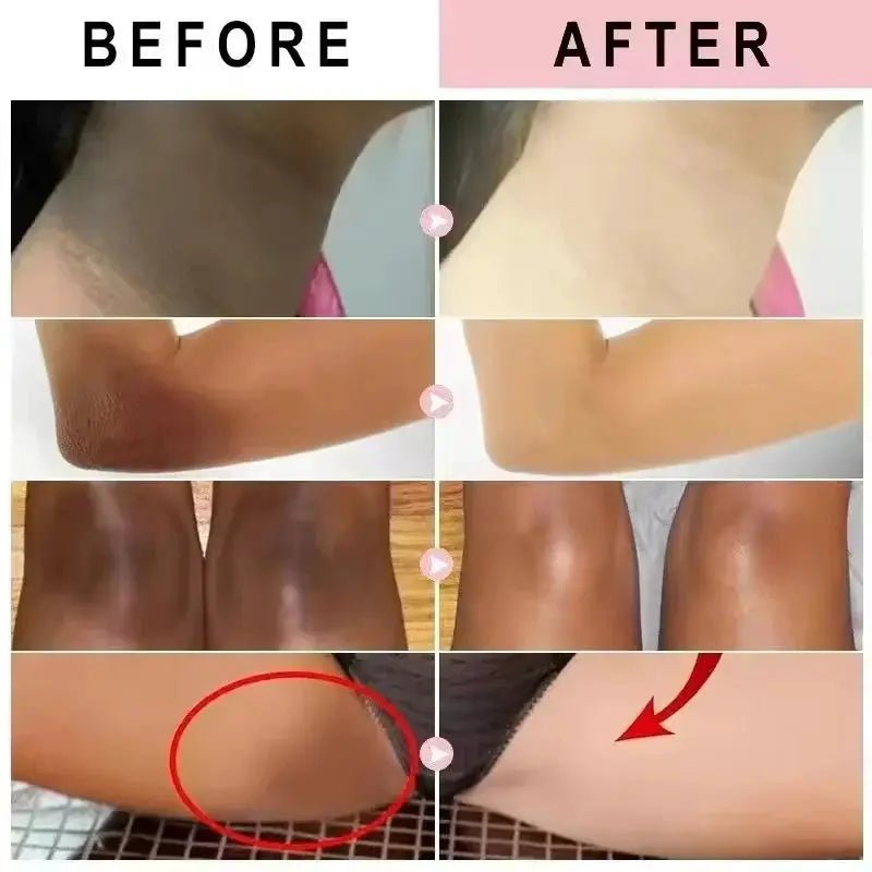Brightening Body Cream for Dark Skin