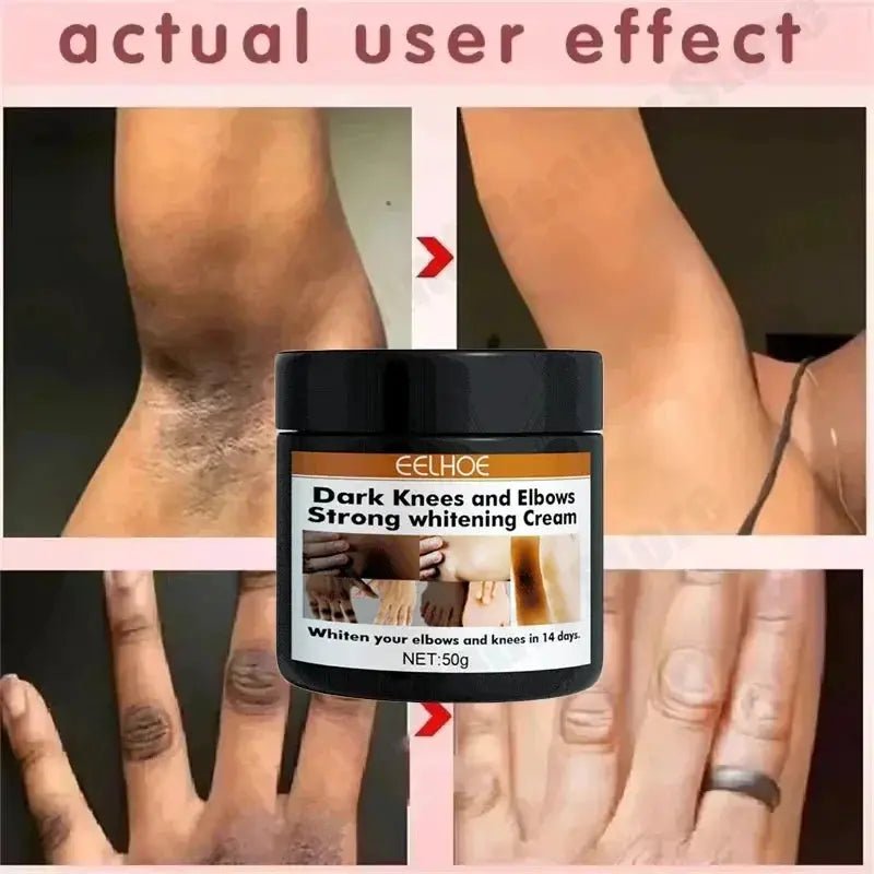 Brightening Body Cream for Private Areas