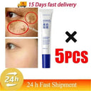 Brightening Cream for Melasma and Spots