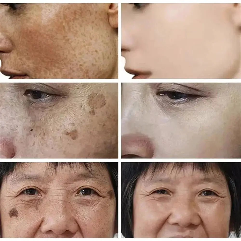 Brightening Cream for Melasma and Spots — product view 12