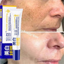 Brightening Cream for Melasma and Spots