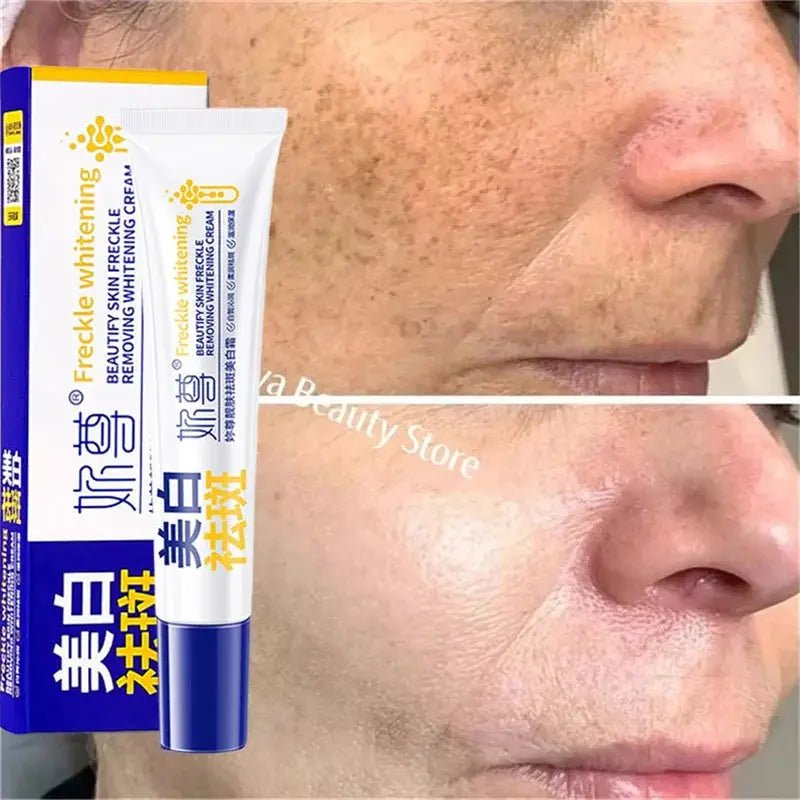 Brightening Cream for Melasma and Spots