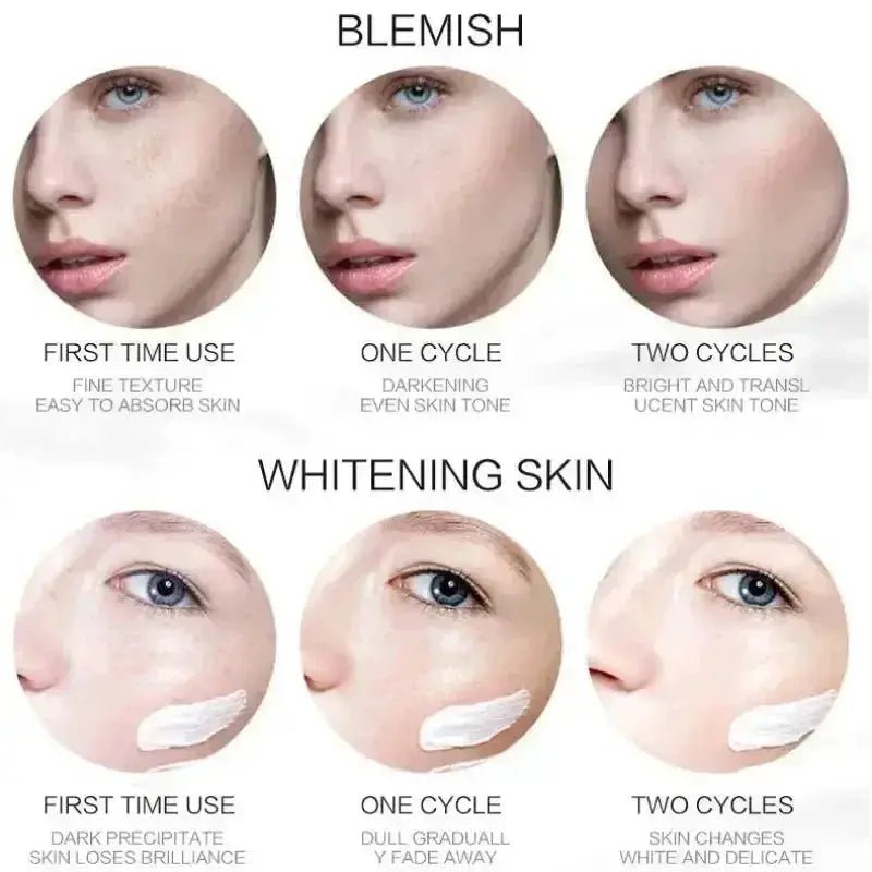 Brightening Freckle Cream for Dark Spots