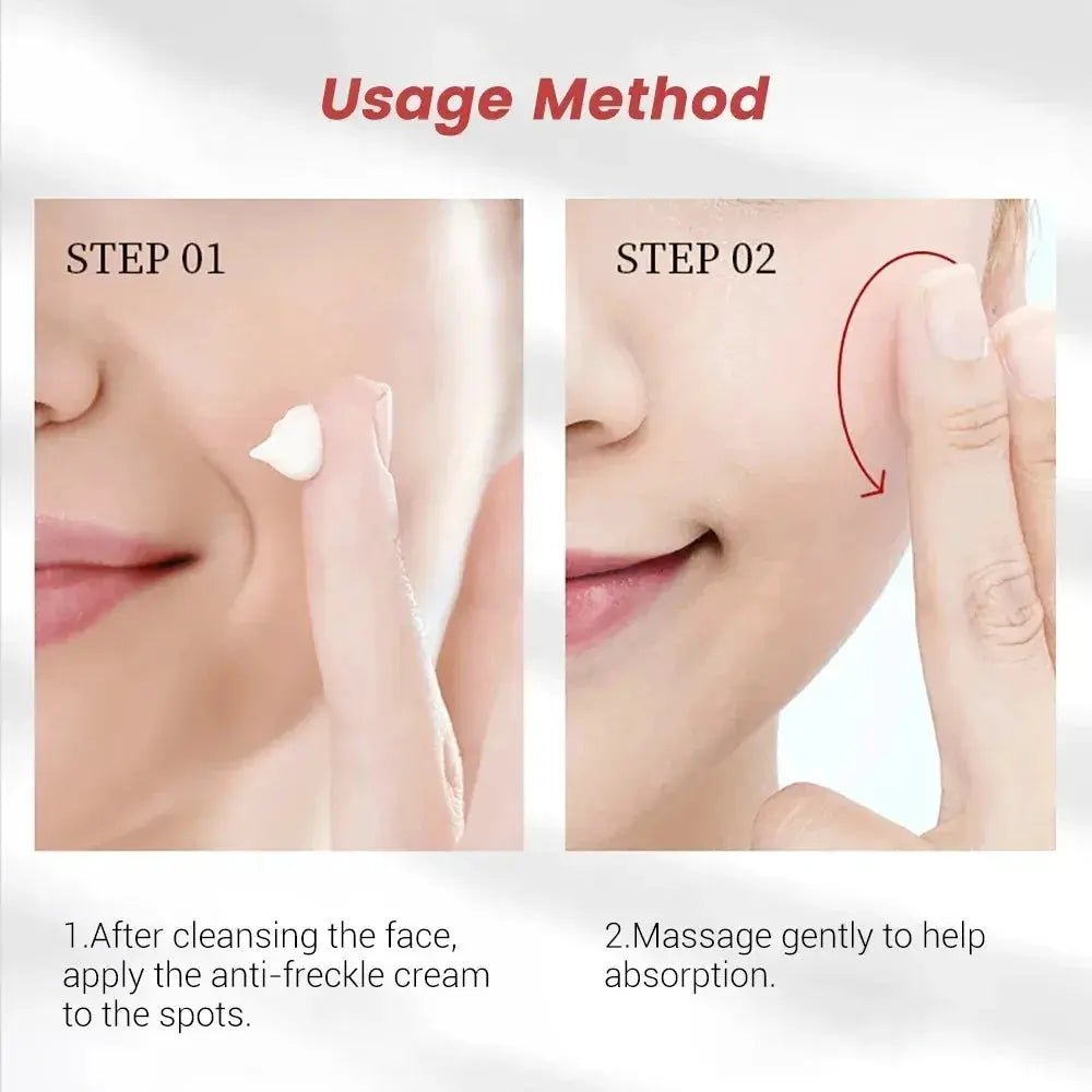 Brightening Freckle Cream for Dark Spots