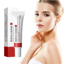 Brightening Freckle Cream for Dark Spots