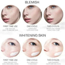 Brightening Freckle Cream for Dark Spots
