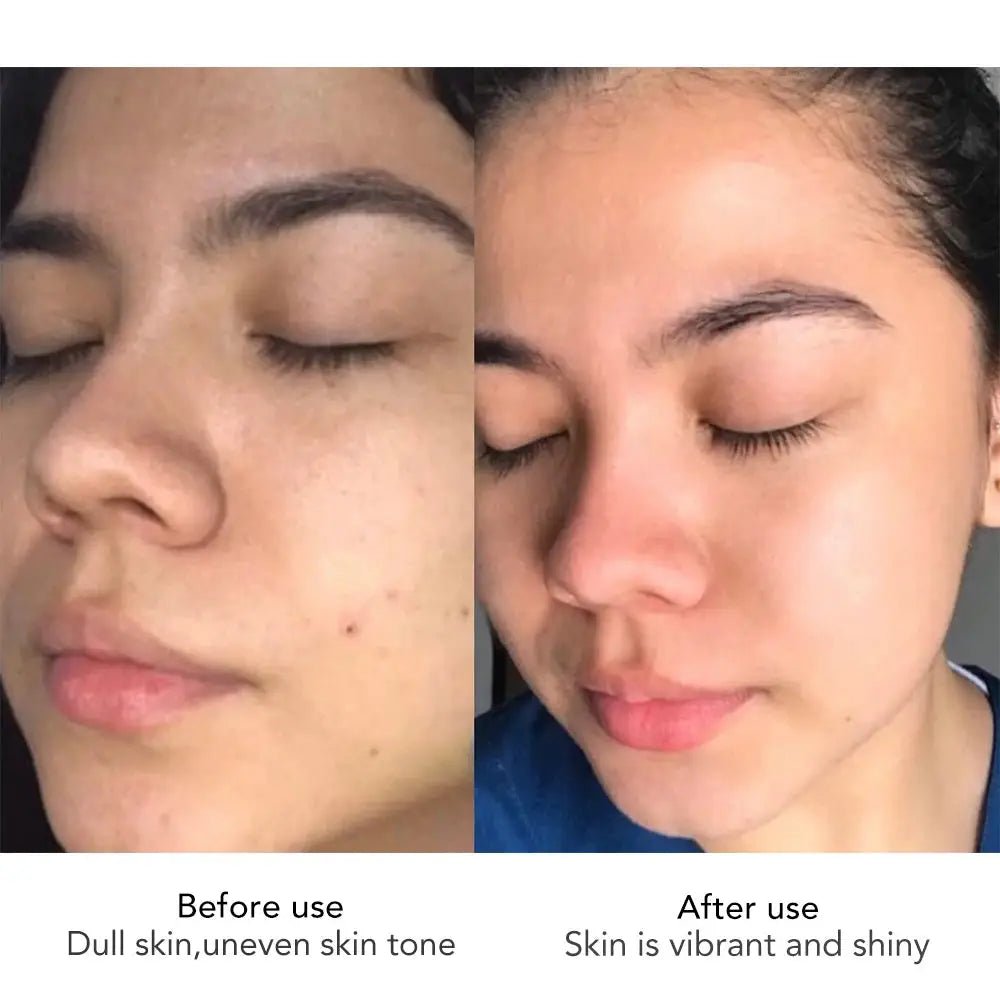 Brightening Hyaluronic Cream for Women
