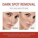 Brightening Melasma Cream for All Skin