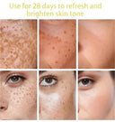 Brightening Melasma Cream for All Skin