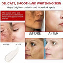 Brightening Melasma Cream for All Skin