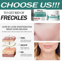 Brightening Melasma Cream for All Skin | Ourlum
