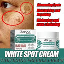 Brightening Melasma Cream for All Skin | Ourlum