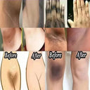 Brightening Underarm Cream for Armpits