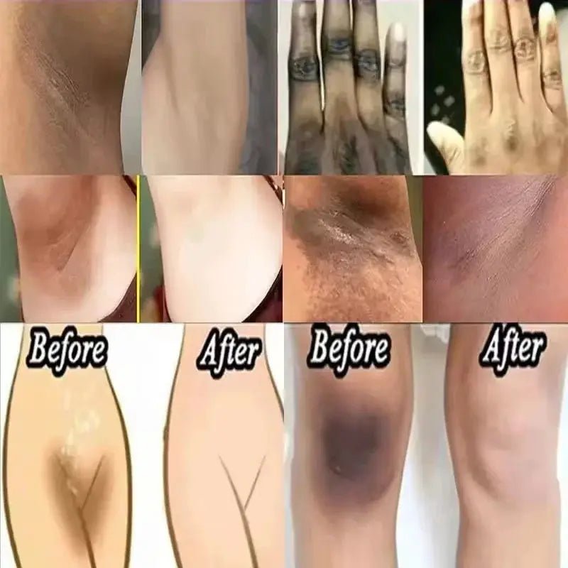 Brightening Underarm Cream for Armpits