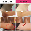 Brightening Underarm Cream for Armpits