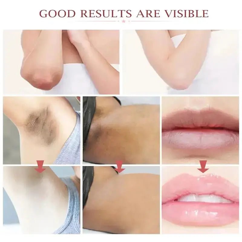 Brightening Underarm Cream for Armpits