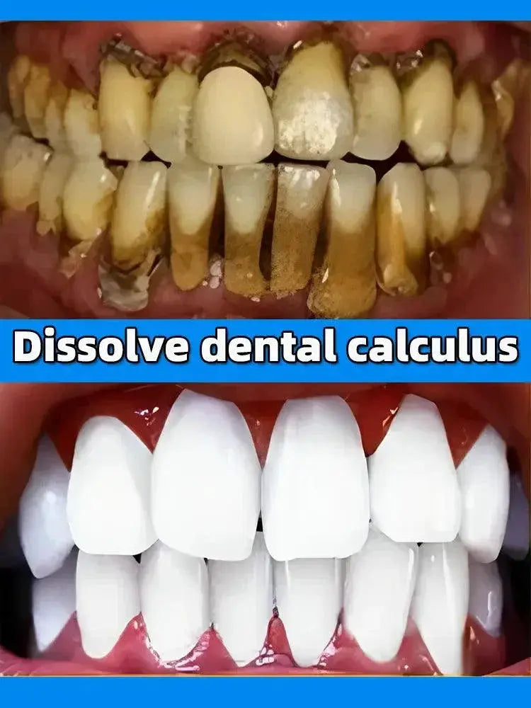 Brightest Smile All In One Whitening Dental Care Solution