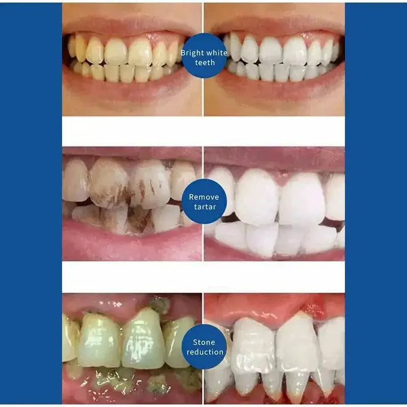 Brightest Smile All In One Whitening Dental Care Solution