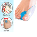 Bunion Corrector Set: Orthopedic Toe Separators for Comfort