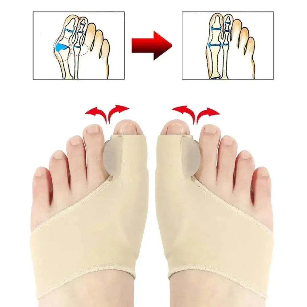 Bunion Relief Kit Instant Comfort And Toe Protection Set