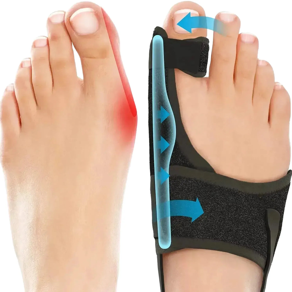 Bunion Splint for Hallux Pain Relief — product view 1