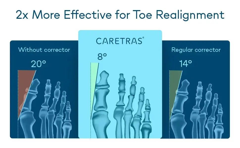 Bunion Splint for Hallux Pain Relief — product view 8