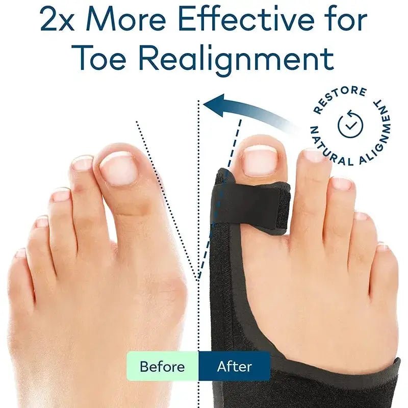 Bunion Splint for Hallux Pain Relief