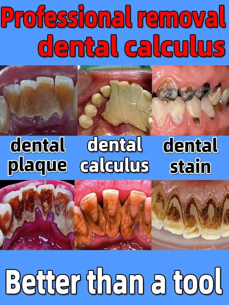 Calculus Clear Lemon Whitening Solution for Bright Teeth