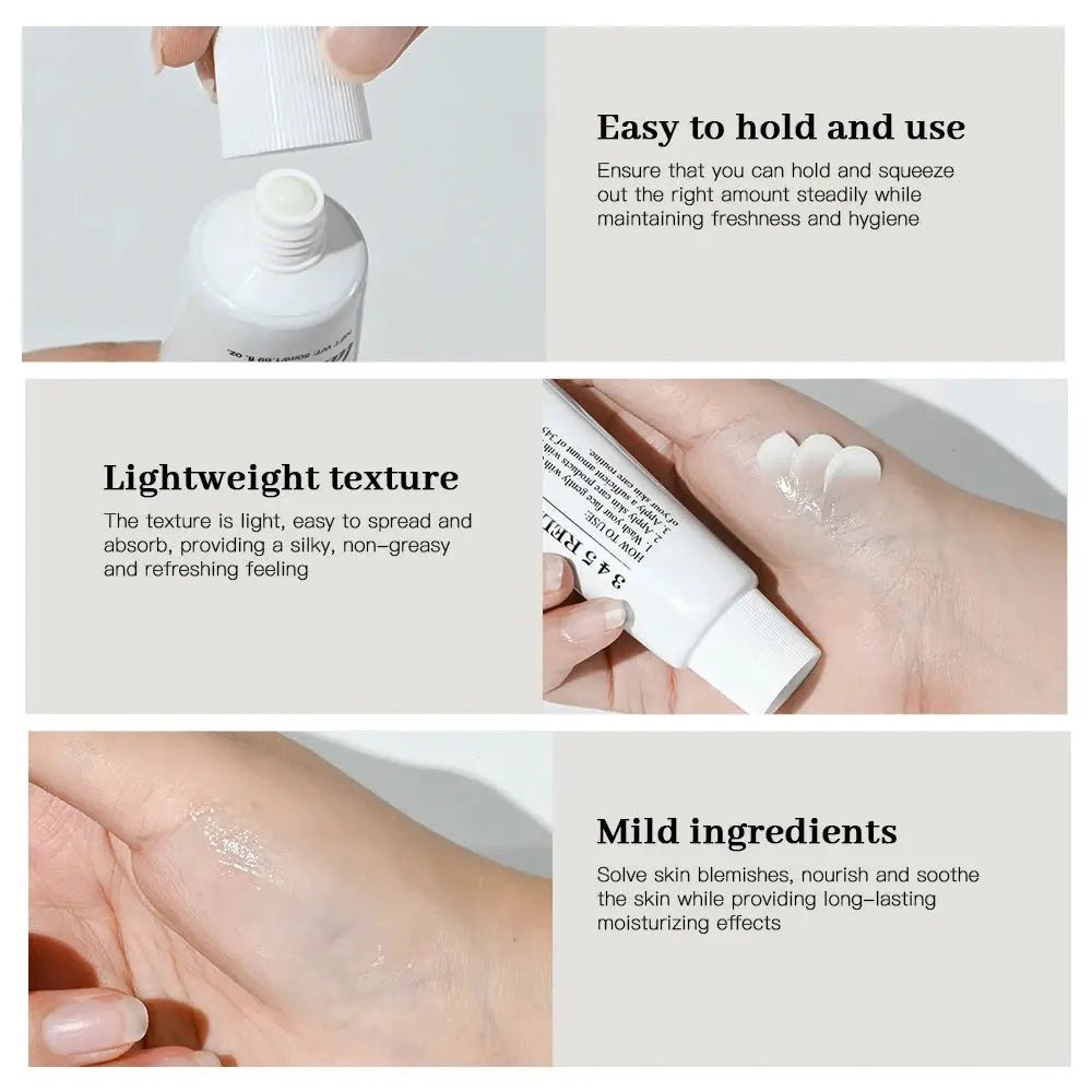 Calms Irritation Relief Cream for Acne