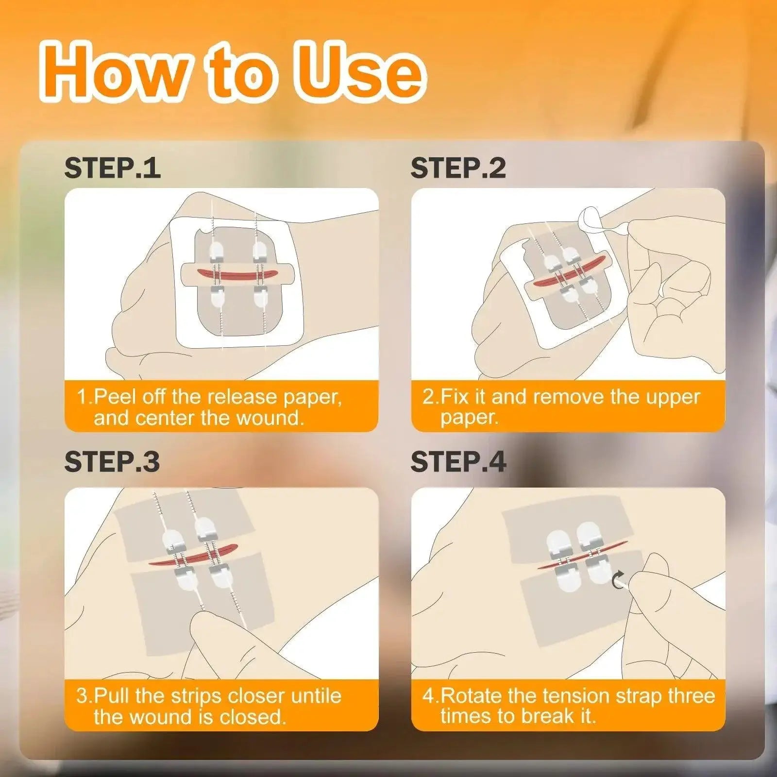 Carbou Quick Healing Zip Sutures And Butterfly Bandaids Kit