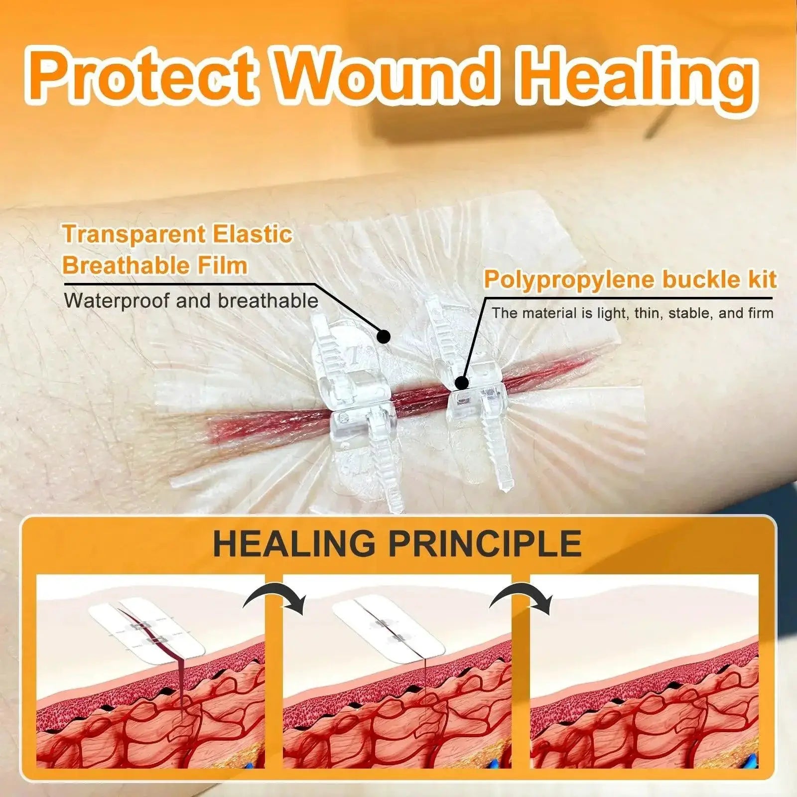 Carbou Quick Healing Zip Sutures And Butterfly Bandaids Kit