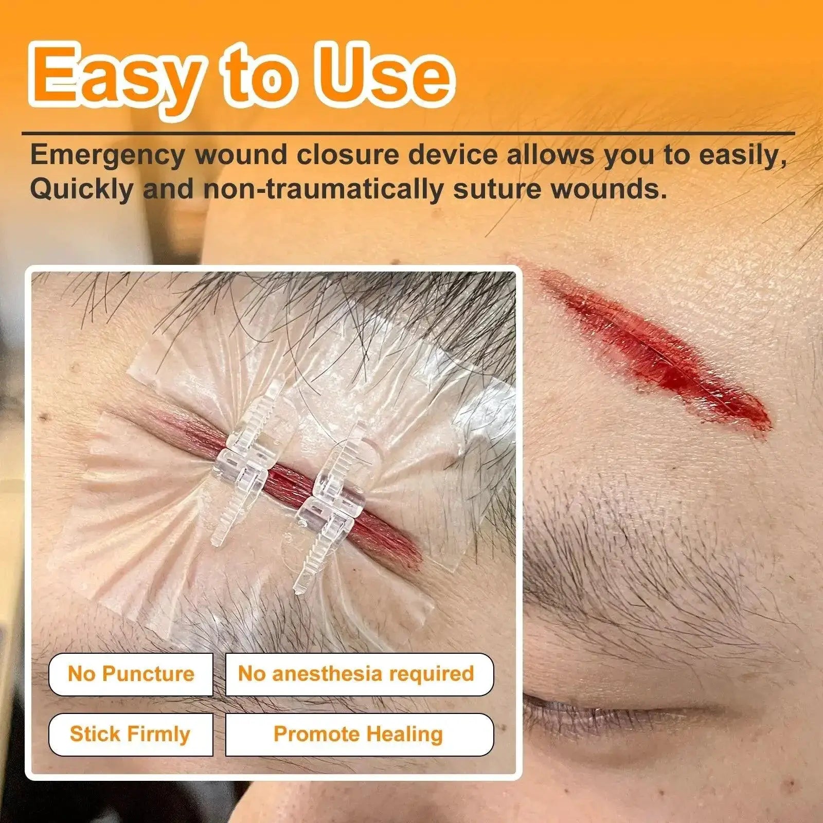 Carbou Quick Healing Zip Sutures And Butterfly Bandaids Kit