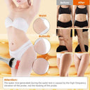 Cavitation Slimming Device For Home Use