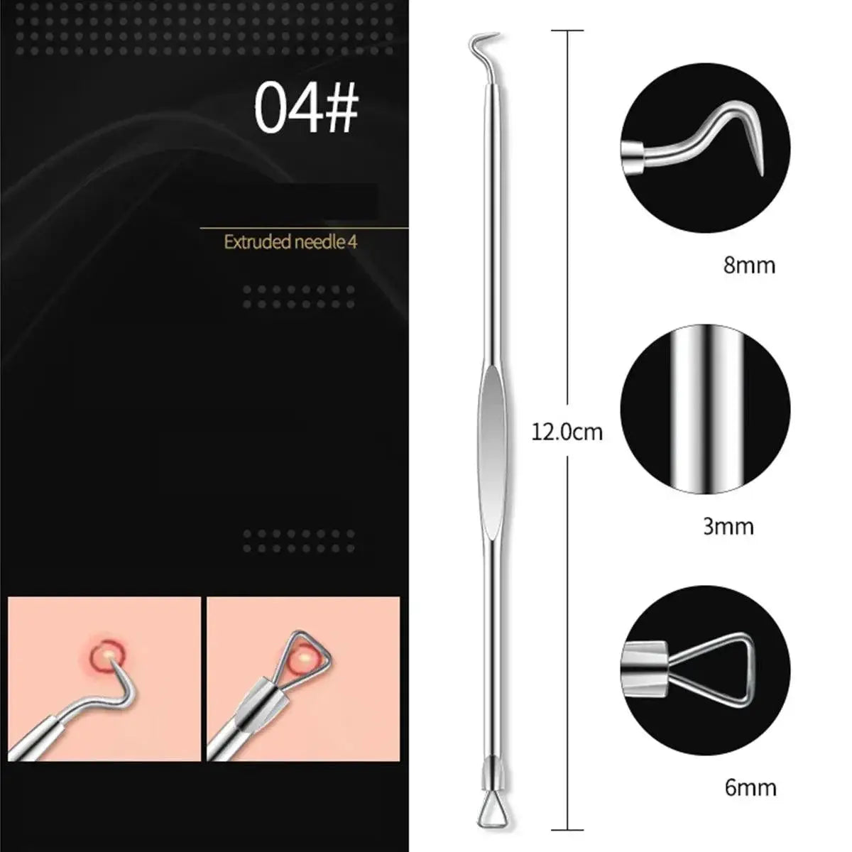 Clear Skin Acne Extraction Kit Gentle Pore Cleanser Tools