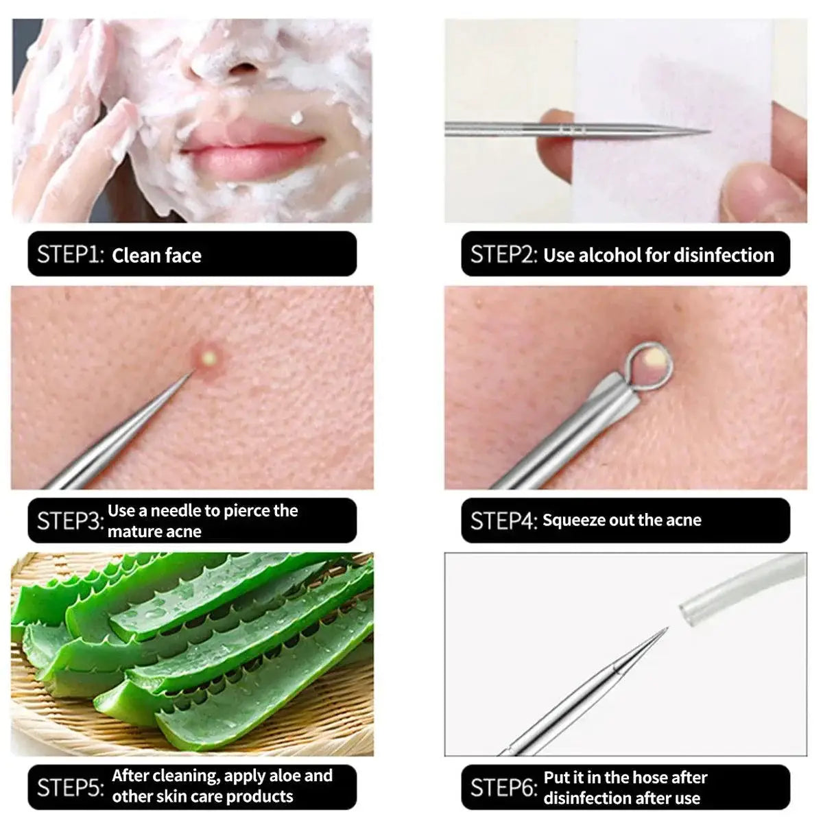 Clear Skin Acne Extraction Kit Gentle Pore Cleanser Tools