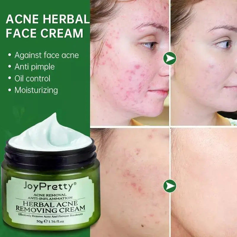 ClearSkin Herbal Acne Cream Plant Powered Skin Solution
