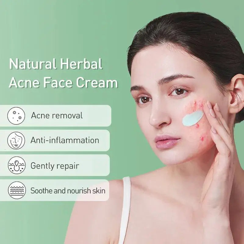 ClearSkin Herbal Acne Cream Plant Powered Skin Solution