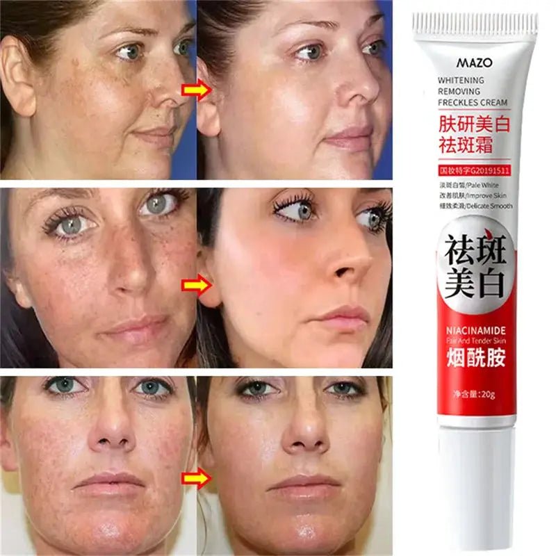 Daily Brightening Cream for Dark Spots