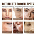 Daily Brightening Cream for Dark Spots
