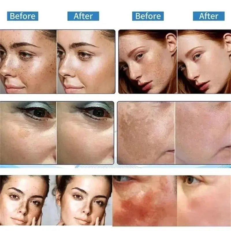 Daily Brightening Cream for Dark Spots