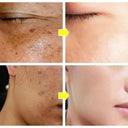 Daily Brightening Cream for Dark Spots