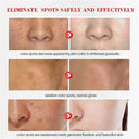 Daily Brightening Cream for Dark Spots