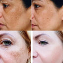 Daily Brightening Cream for Dark Spots