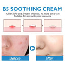 Eelhoe Repair Cream for Sensitive Skin