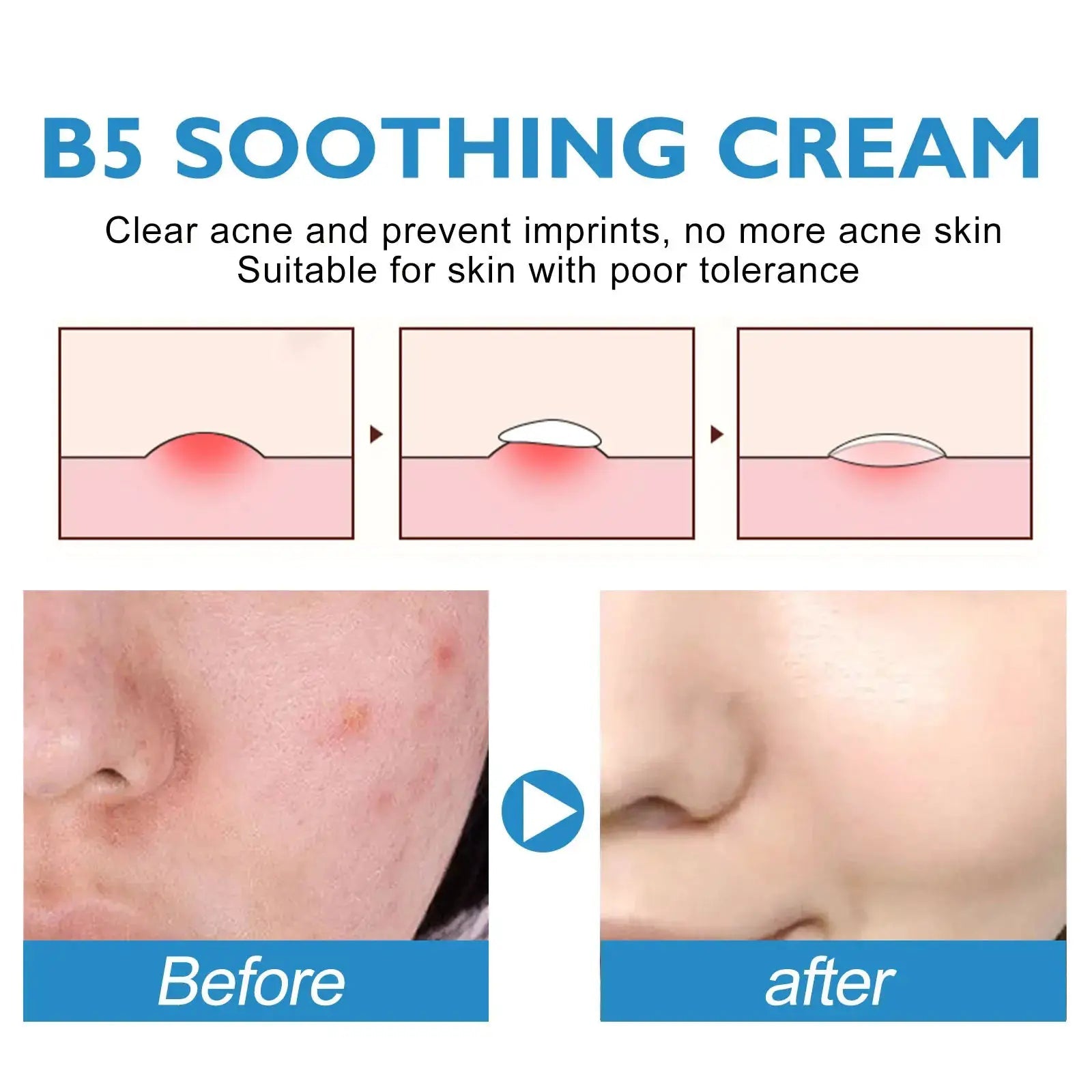 Eelhoe Repair Cream for Sensitive Skin