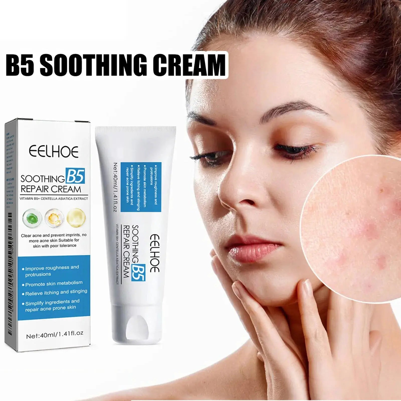 Eelhoe Repair Cream for Sensitive Skin