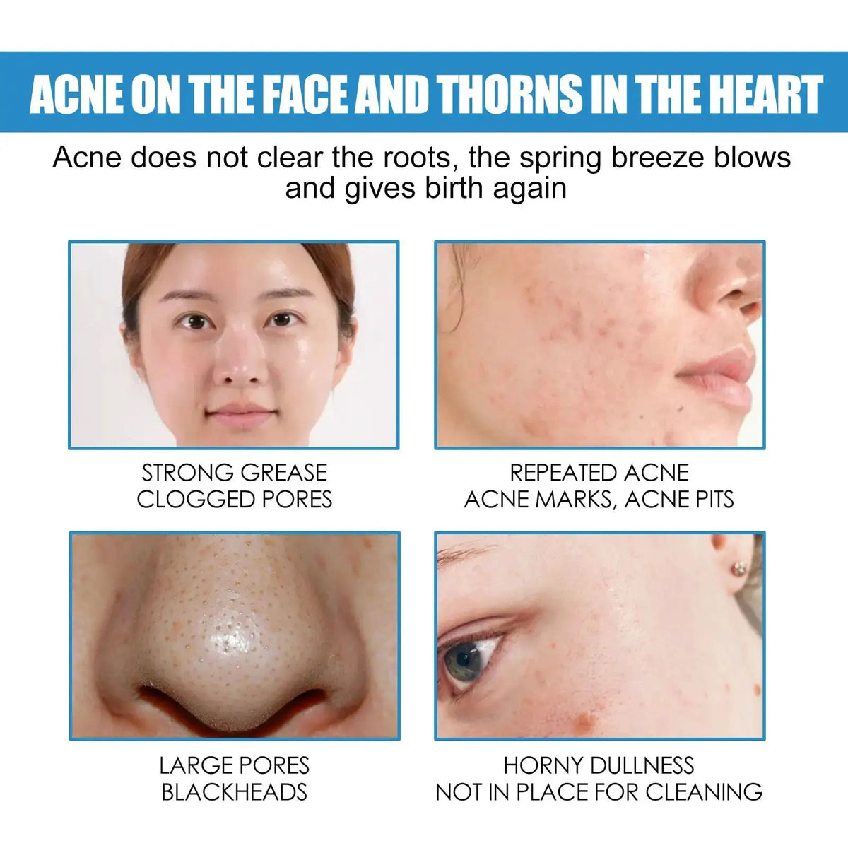 Eelhoe Repair Cream for Sensitive Skin — product view 9